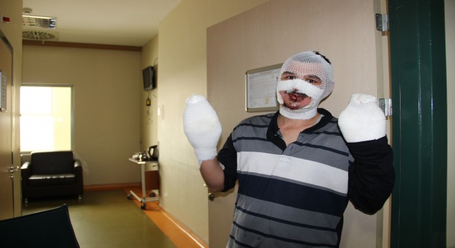 Sobaya benzin döktü yandı