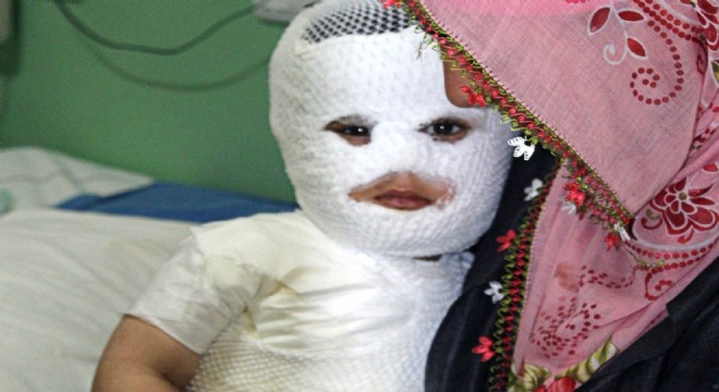 Doğu'da 400 kişi tandır ve süt kazanında yandı