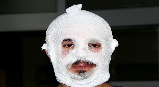 Merdiven altı kremle tanınmaz hale geldi